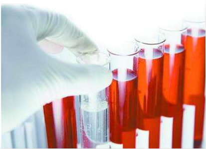 医用海角社交入口APP厂家谈微量元素的检查流程